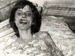 Su cuerpo se demacró y deterioró