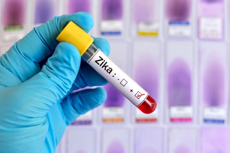 Incredibile! Studi Virus Zika utili per contro un tipo di Tumore al Cervello | Salute News