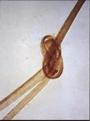 Featured image of post Triconodose