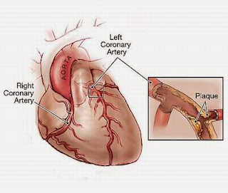 Blood pressure ka ilaj Urdu and Hindi.Control Blood Pressure Blood pressure ka ilaj Urdu and Hindi.Control Blood Pressure