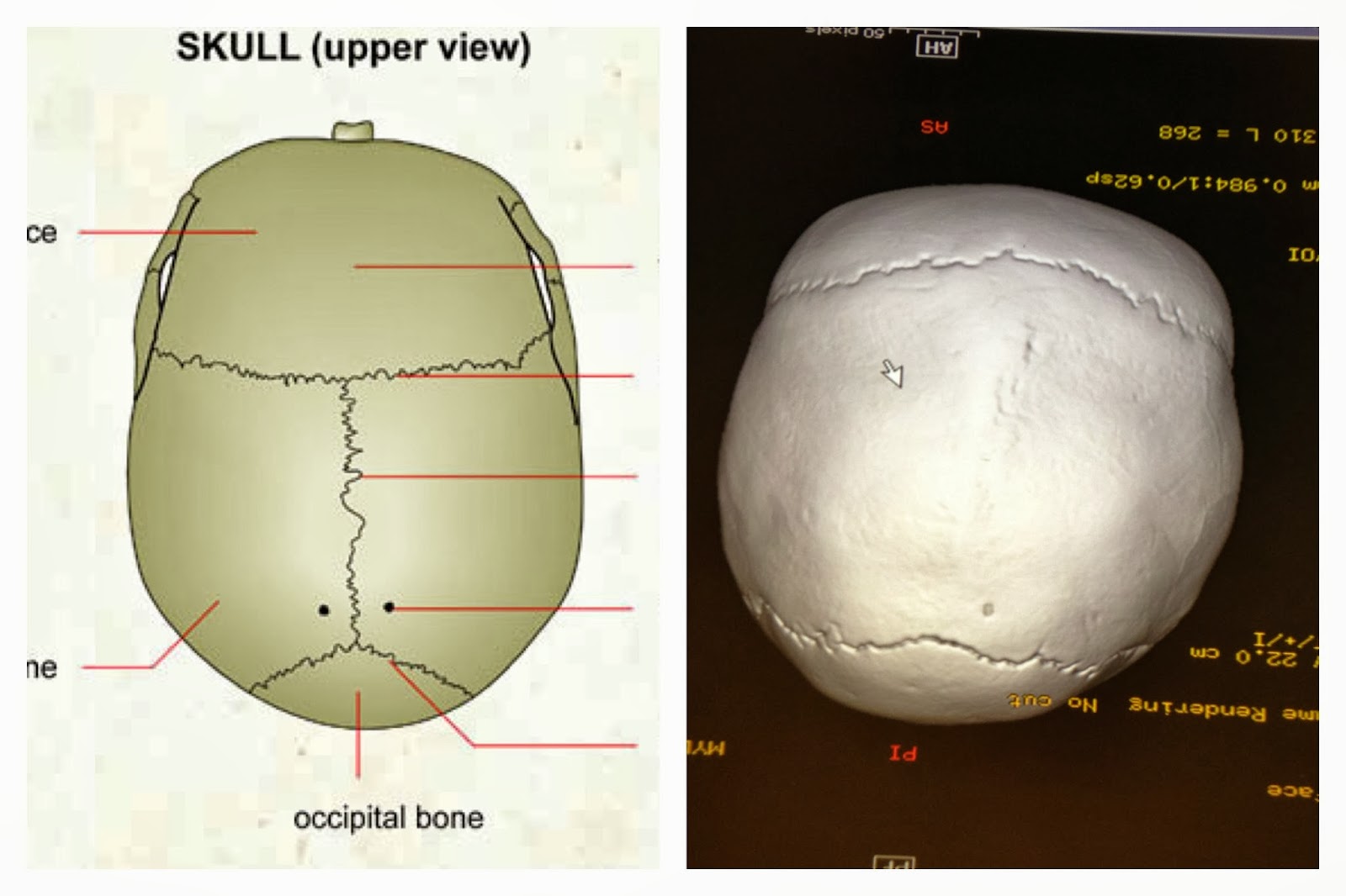 The Adventures of Our Cranio Baby Finn Finn's Diagnosis