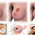 DOCTORS WARN WOMEN: STOP WEARING BRAS! THE REASONS ARE THESE…