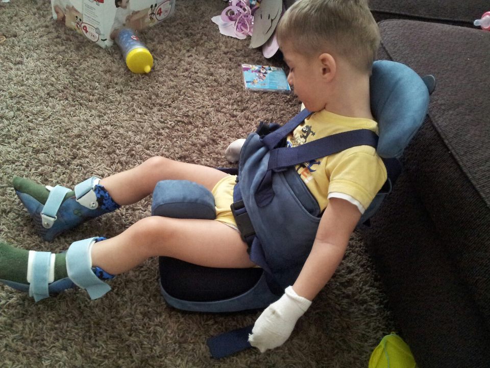 Spastic Quadriplegic Cerebral Palsy Medical Equipment