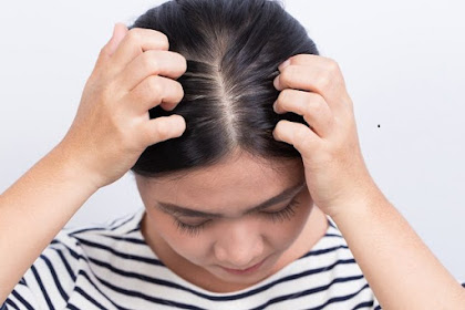 How To Overcome Dandruff which Somewhat Effective