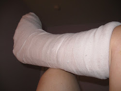 This cast/splint was put on after surgery