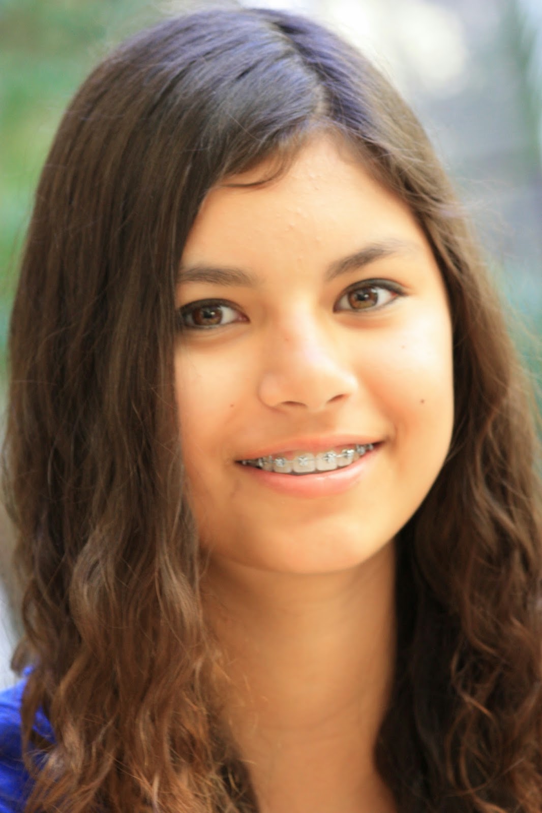 Color Me Braces or Invisalign with South Bay Dental Cosmetic orthodontic treatments for children, teens and adults