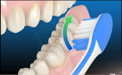 Nha sĩ chỉ cách chăm sóc răng miệng sau khi tẩy trắng răng-2