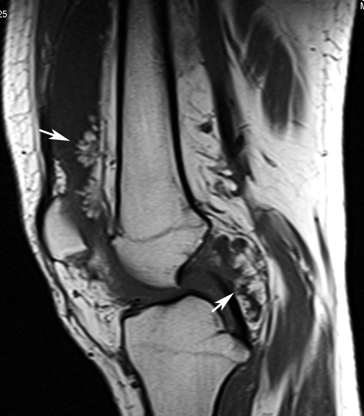 RADIODIAGNOSIS IMAGE COLLECTION June 2011 radiodiagnosis-image-collection-june-2011