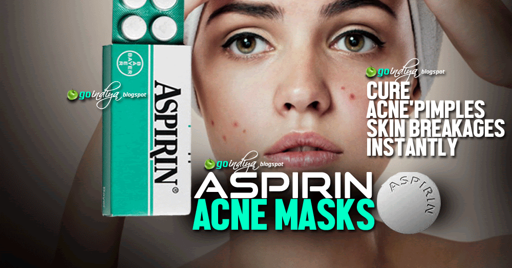 4 Aspirin Acne Masks Cure Pimples, Skin Breakages Instantly Natural