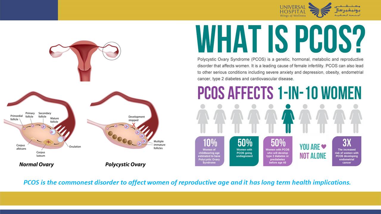 Polycystic Ovary Syndrome (PCOS) - Dr. Mayada Younis, Specialist - OBGYN @U...