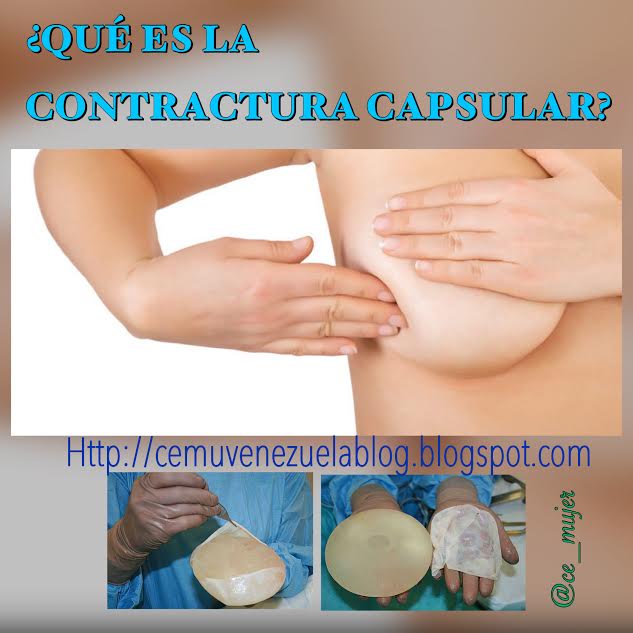 La crema para podtyagivaniya los pechos
