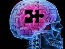 Αλτσχάιμερ - ALZHEIMER ALZHEIMER