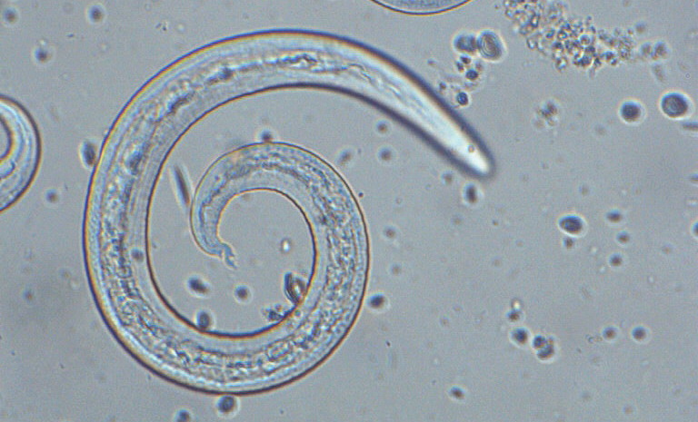 plan detoxifiere 7 zile tratamentul viermilor și nematodelor