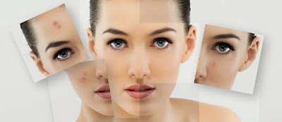 ageless beauty, timeless skin: What is Post-Inflammatory Hyperpigmentation?