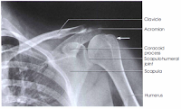 AP PROJECTION - EXTERNAL ROTATION: SHOULDER (NONTRAUMA) - RadTechOnDuty