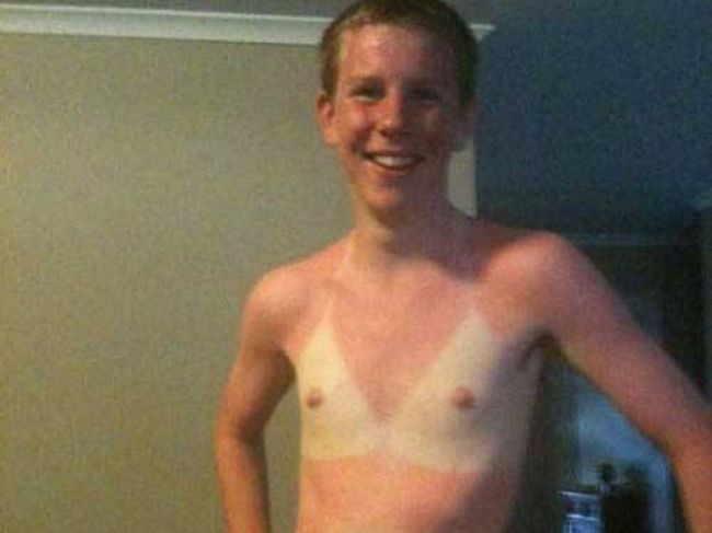 21 The Most Embarrassing Tan Lines Of This Summer