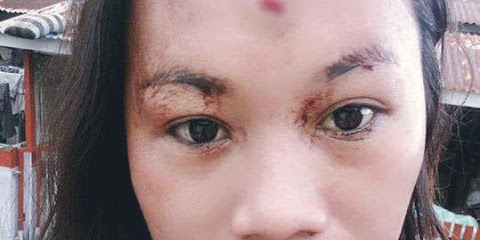 Seorang Suami Tega Membacok Istri Sendiri Karna Gengsi Jadi Pengangguran