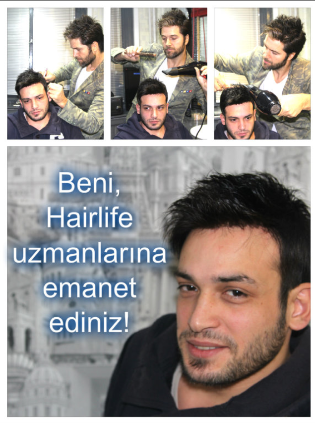 protez sac protez sac istanbul protez sac ankara aralik 2016