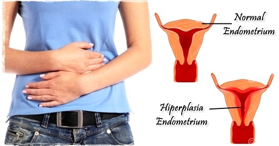 Cara Mengobati Penebalan Lapisan Dinding Rahim | Manfaat Daun Sirsak