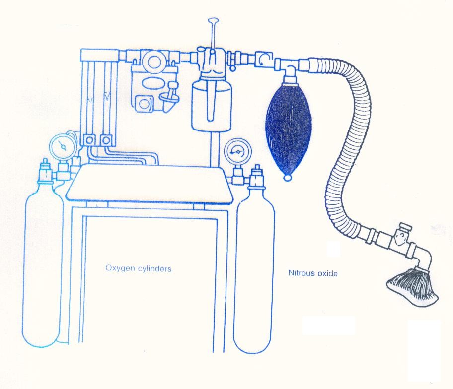 OTMANAGE ANESTHESIA Procedure 1 2+3 INSTRUMENTS