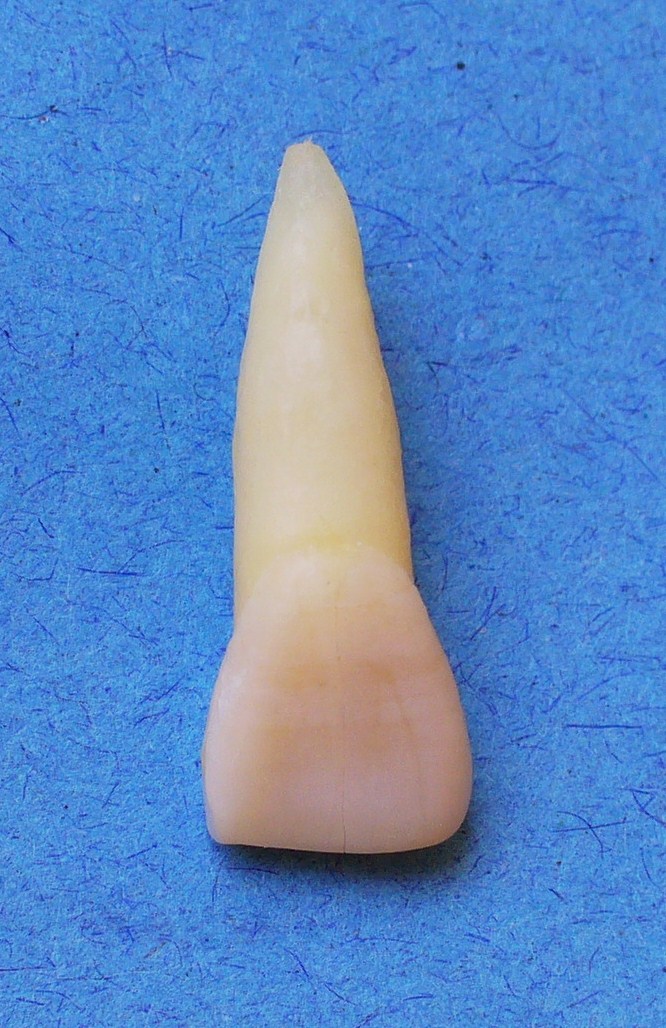 Anatomia Dental CARA LABIAL DEL INCISIVO CENTRAL SUPERIOR Anatomia Dental CARA LABIAL DEL INCISIVO CENTRAL SUPERIOR