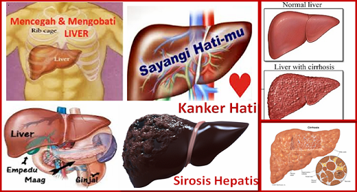 76+ Gambar Organ Hati Yang Rusak Paling Hist 76+ Gambar Organ Hati Yang Rusak Paling Hist