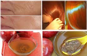 health benefits of apple cider vinegar in urdu