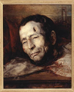 partial portrait of Giuseppe Fieschi from the head up because the French had cut his head off.