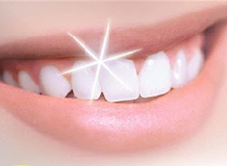 blanqueamiento dental, carillas estéticas, carillas de porcelana, sonrisa perfecta, snowdent, clínica dental, 