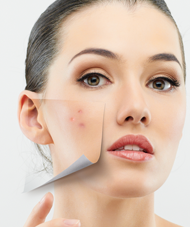 7 cara mengobati mata bintitan dengan cepat halaman all CARA CEPAT AMPUH MENGHILANGKAN JERAWAT DENGAN SECARA ALAMI