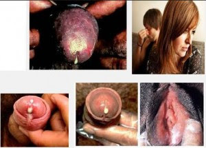 Obat Gonore Ampuh Untuk Pria Modern Dengan Khasiat Alami Obat Gonore Ampuh Untuk Pria Modern Dengan Khasiat Alami