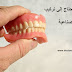 الحالات التي تحتاج إلى تركيب اسنان صناعية