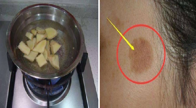 Tak Harus ke Salon, Cukup Oleskan Campuran Jahe ini, Wajah Seketika Putih dan Muda Dalam Waktu Singkat Tak Harus ke Salon, Cukup Oleskan Campuran Jahe ini, Wajah Seketika Putih dan Muda Dalam Waktu Singkat