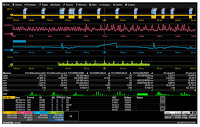 Use tracks and trends to identify trouble spots in a serial link Use tracks and trends to identify trouble spots in a serial link