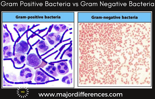 gram positive vs gram negative antibiotic gram positive vs gram negative antibiotic