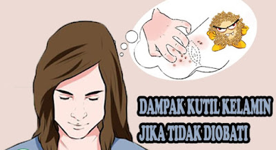 obat untuk kutil kelamin di apotik yang bagus