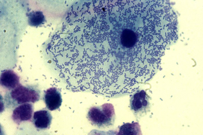 Гарднерелла откуда появляется. Гарднерелла вагиналис. Гарднерелла выделения. Гарднерелла откуда появляется. Гарднереллы (gardnerella vaginalis).