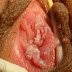 Obat Tradisional Penyakit Kondiloma Akuminata thumbnail