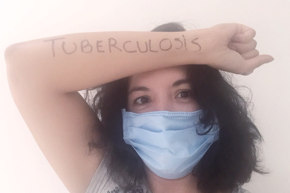 Cómo detectar si tus hijos padecen tuberculosis?