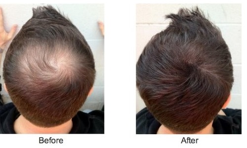 Caboki, cómo funciona Conoce los beneficios y cómo funciona este producto para el cabello.