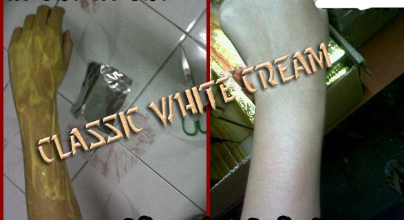 classic white soap for pimples