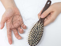 Cara Mengatasi Rambut Rontok dan Kering Secara Mudah dan Alami Cara Mengatasi Rambut Rontok dan Kering Secara Mudah dan Alami