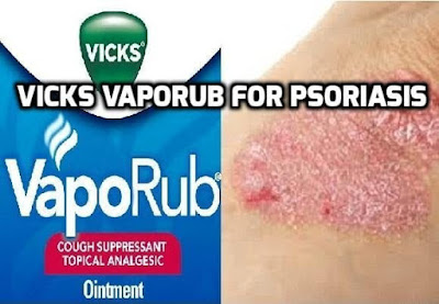 Vicks VapoRub Is More Versatile Than You Think. Here Are 40 Clever Uses You Didn't Know!