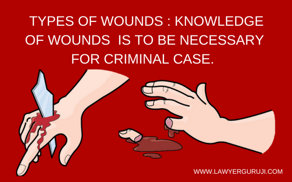 À¤ À¤µ À¤ À¤ À¤ À¤¤à¤¨ À¤ª À¤°à¤ À¤° À¤ À¤¹ À¤¤ À¤¹ À¤à¤° À¤à¤ªà¤° À¤§ À¤ À¤® À¤®à¤² À¤® À¤ À¤µ À¤ À¤ À¤ À¤¨ À¤¹ À¤¨ À¤à¤° À¤° À¤¹ Types Of Wounds Knowledge Of Wounds Is To Be Necessary For Criminal Case Lawyerguruji Incised meaning in hindi : à¤ à¤µ à¤ à¤ à¤ à¤¤à¤¨ à¤ª à¤°à¤ à¤° à¤ à¤¹ à¤¤ à¤¹