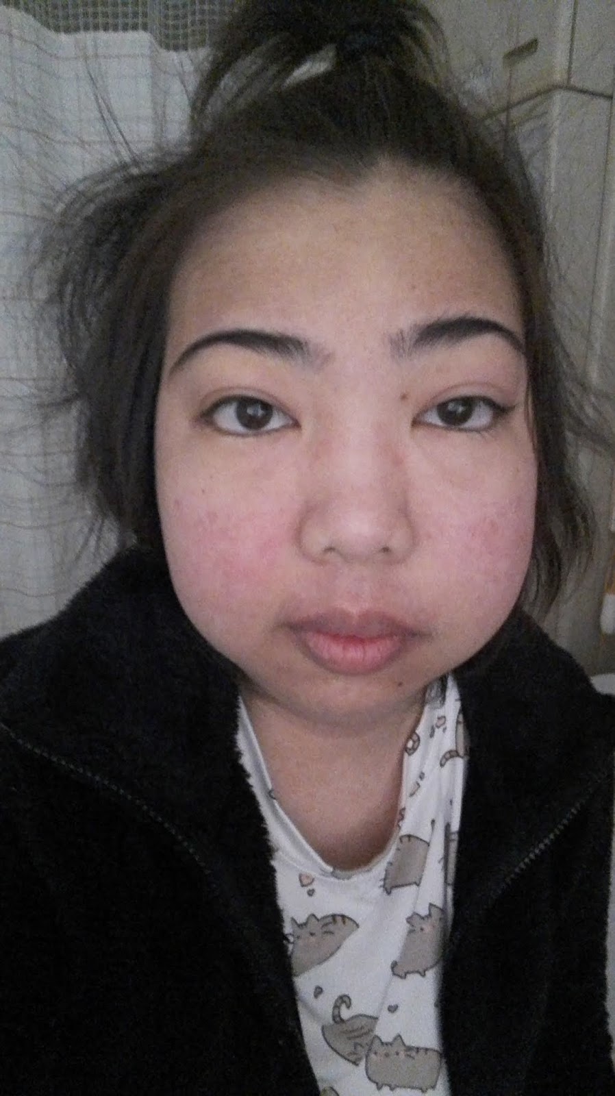 Fighting Lupus in Japan New roller coaster ride! July 20, 2018 (Friday)