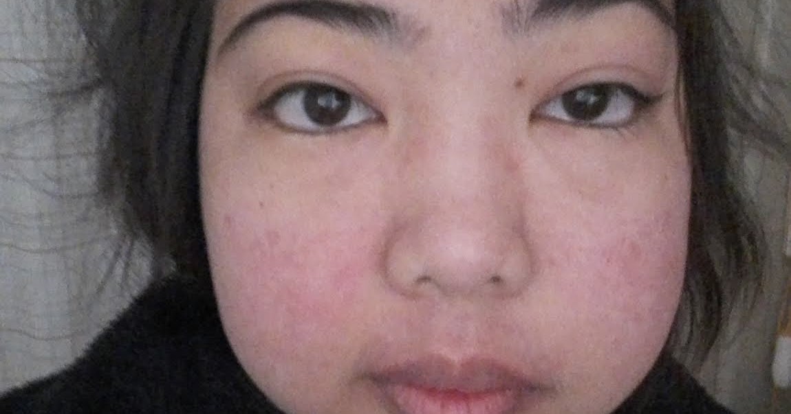 Fighting Lupus in Japan New roller coaster ride! July 20, 2018 (Friday)