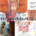 Berobat Wasir Tanpa Harus Ke Dokter thumbnail