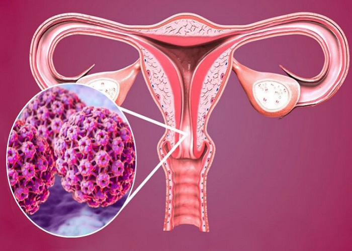 5 Sinais Que Podem Indicar a Existência De Ferida No Colo Do Útero Saúde & Conhecimento