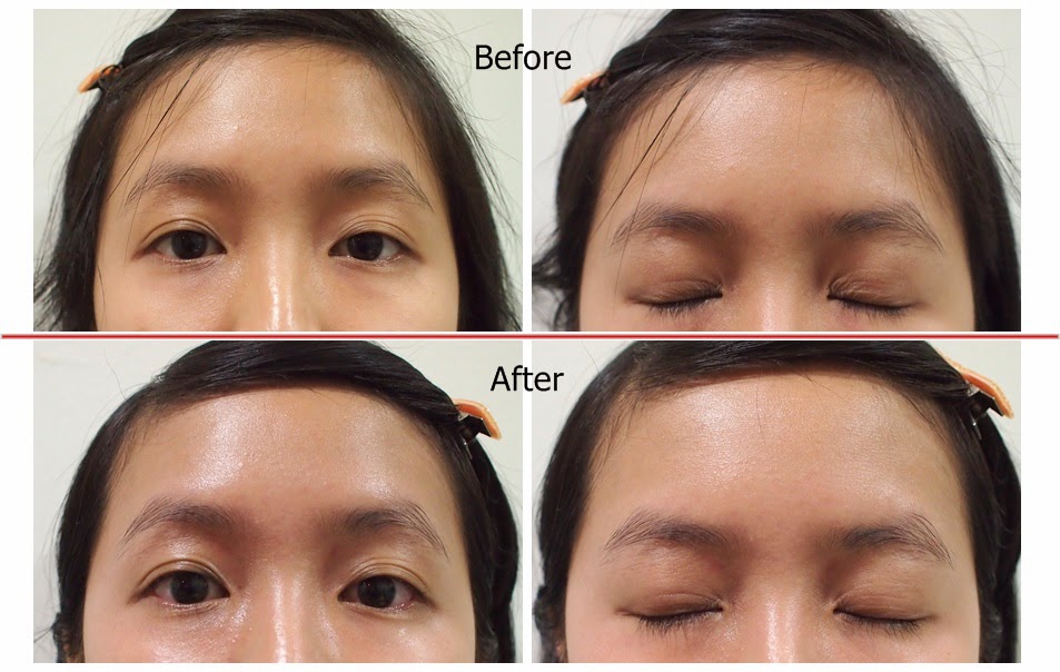 Eye Gua Sha Detox Treatment Total Perfection, Johor Bahru 乐乐的分享