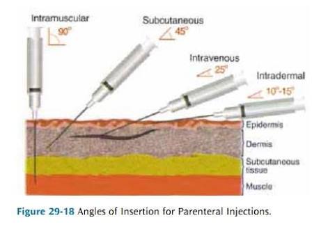 nursing injection iv angles parenteral injections im administration nurse dosage intramuscular form medical sc guide drug nurses study tips survival